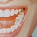 Unsere Schleimhaut – das sensible schlaue Schutzsystem / Teil I Unsere Schleimhaut – das sensible schlaue Schutzsystem / Teil I